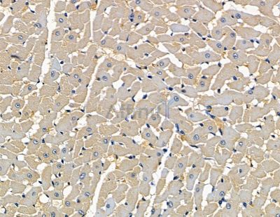FKBP1B Antibody - DF15840 at 1/100 staining rat heart tissue by IHC-P.