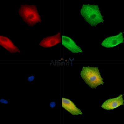 FKBP1B Antibody - DF15840 staining A549 cells by IF/ICC.