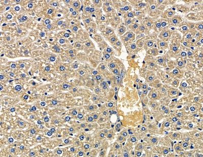 ASTN2 Antibody - DF15849 at 1/100 staining mouse liver tissue by IHC-P.
