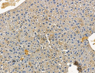 ABI3BP Antibody - DF15851 at 1/100 staining mouse liver tissue by IHC-P.