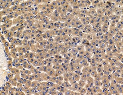 PLGRKT Antibody - DF15855 at 1/100 staining rat liver tissue by IHC-P.
