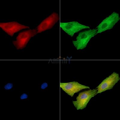 PLGRKT Antibody - DF15855 staining A549 cells by IF/ICC.