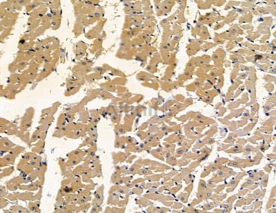 NUDT18 Antibody - DF15860 at 1/100 staining rat heart tissue by IHC-P.