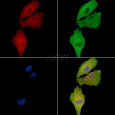 ZDHHC14 Antibody - DF15863 staining A549 cells by IF/ICC.