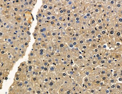 TMEM63B Antibody - DF15864 at 1/100 staining mouse liver tissue by IHC-P.