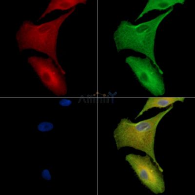 TMEM63B Antibody - DF15864 staining A549 cells by IF/ICC.