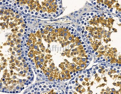 KLHDC8A Antibody - DF15865 at 1/100 staining mouse testis tissue by IHC-P.