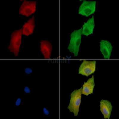SLC25A42 Antibody - DF15871 staining A549 cells by IF/ICC.