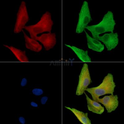 NIPSNAP3A Antibody - DF15873 staining A549 cells by IF/ICC.