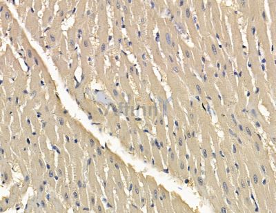 SLC36A2 Antibody - DF15880 at 1/100 staining rat heart tissue by IHC-P.