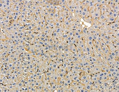 SLC22A14 Antibody - DF15882 at 1/100 staining mouse liver tissue by IHC-P.