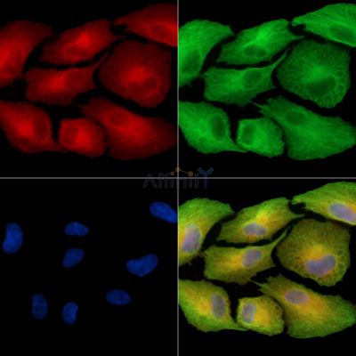 SLC22A14 Antibody - DF15882 staining A549 cells by IF/ICC.