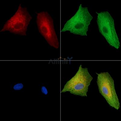 GRAMD2A Antibody - DF15893 staining A549 cells by IF/ICC.
