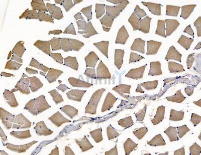C21orf62 Antibody - DF15897 at 1/100 staining rat muscle tissue by IHC-P.