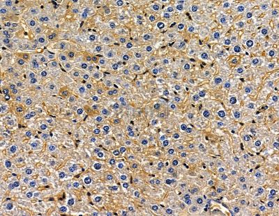 CYB5D2 Antibody - DF15903 at 1/100 staining mouse liver tissue by IHC-P.