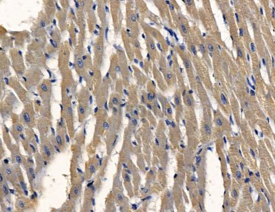 WDR45B Antibody - DF15906 at 1/100 staining rat heart tissue by IHC-P.