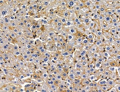 TNNI1 Antibody - DF15907 at 1/100 staining mouse liver tissue by IHC-P.