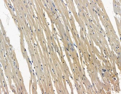 AGTRAP Antibody - DF15908 at 1/100 staining rat heart tissue by IHC-P.