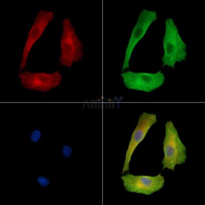 BTBD1 Antibody - DF15910 staining A549 cells by IF/ICC.