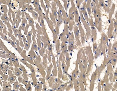 PHACTR2 Antibody - DF15911 at 1/100 staining rat heart tissue by IHC-P.