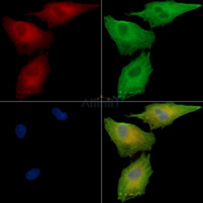 PHACTR2 Antibody - DF15911 staining A549 cells by IF/ICC.