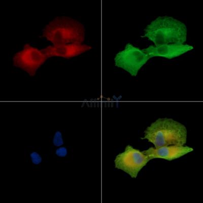B3GALNT2 Antibody - DF15917 staining A549 cells by IF/ICC.