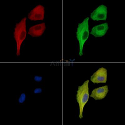 ARHGAP29 Antibody - DF15926 staining A549 cells by IF/ICC.