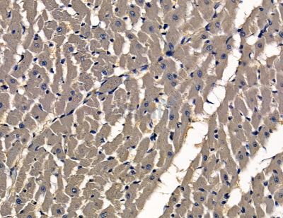 SASS6 Antibody - DF15931 at 1/100 staining rat heart tissue by IHC-P.