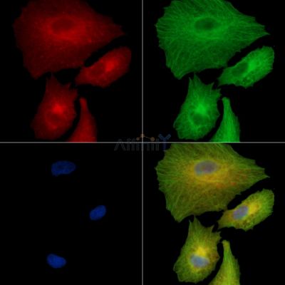 FBXO31 Antibody - DF15940 staining A549 cells by IF/ICC.