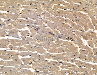 PLAC9 Antibody - DF15945 at 1/100 staining rat heart tissue by IHC-P.