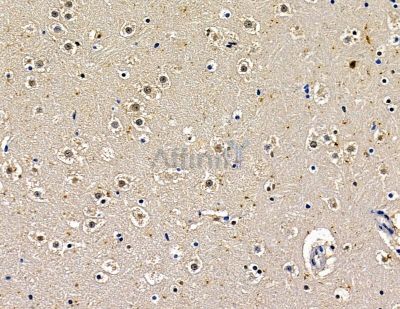 POU6F2 Antibody - DF15946 at 1/100 staining mouse brain tissue by IHC-P.