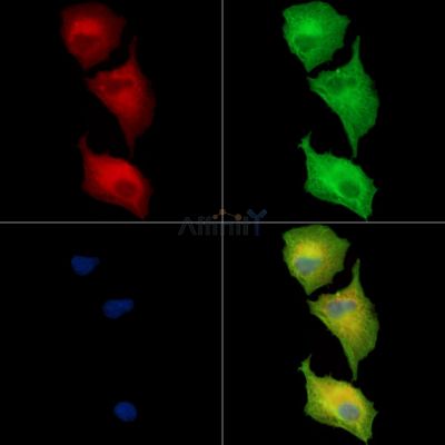 DHX57 Antibody - DF15958 staining A549 cells by IF/ICC.