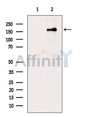 USP32 Antibody - Western blot analysis of extracts from HepG2 cells(heat-shock treatment), using USP32 Antibody.
