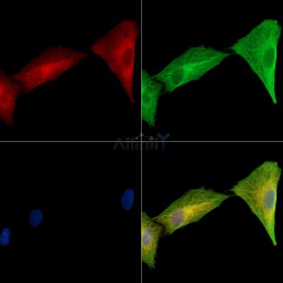 USP32 Antibody - DF15959 staining A549 cells by IF/ICC.