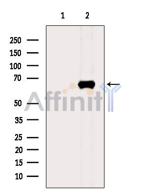 MPP7 Antibody - Western blot analysis of extracts from HepG2 cells(heat-shock treatment), using MPP7 Antibody.