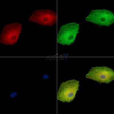MPPE1 Antibody - DF15972 staining A549 cells by IF/ICC.