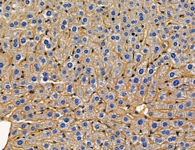 COX18 Antibody - DF15974 at 1/100 staining mouse liver tissue by IHC-P.