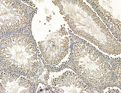 THAP10 Antibody - DF15978 at 1/100 staining rat testis tissue by IHC-P.
