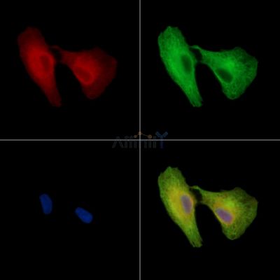 THAP10 Antibody - DF15978 staining A549 cells by IF/ICC.