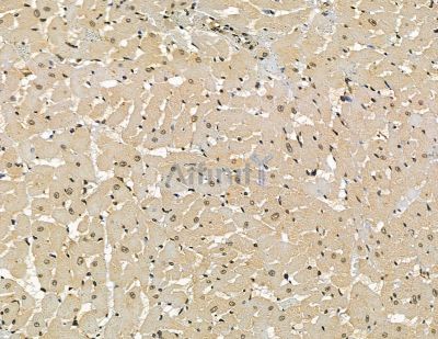 FBXO38 Antibody - DF15979 at 1/100 staining rat heart tissue by IHC-P.