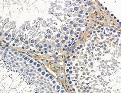 TRMT61B Antibody - DF15985 at 1/100 staining rat testis tissue by IHC-P.