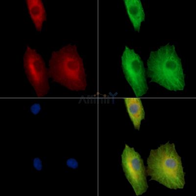 TRMT61B Antibody - DF15985 staining A549 cells by IF/ICC.