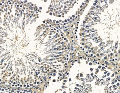 ILDR1 Antibody - DF15987 at 1/100 staining rat testis tissue by IHC-P.