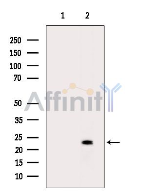 C11orf53 Antibody - Western blot analysis of extracts from Rat liver, using C11orf53 Antibody.