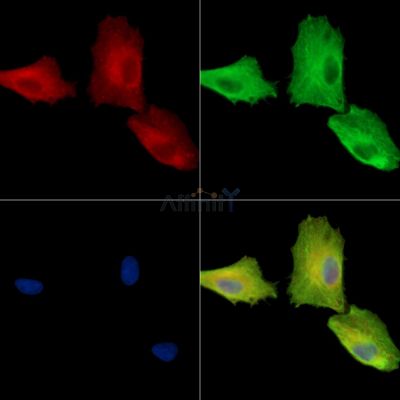 C11orf53 Antibody - DF15993 staining A549 cells by IF/ICC.