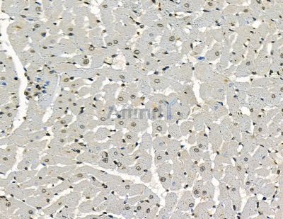 FBXO33 Antibody - DF15994 at 1/100 staining rat heart tissue by IHC-P.