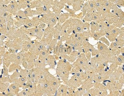 AMIGO3 Antibody - DF15995 at 1/100 staining rat heart tissue by IHC-P.