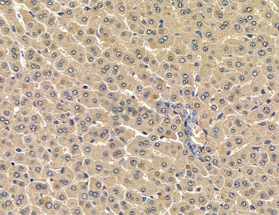 AMIGO3 Antibody - DF15995 at 1/100 staining rat liver tissue by IHC-P.
