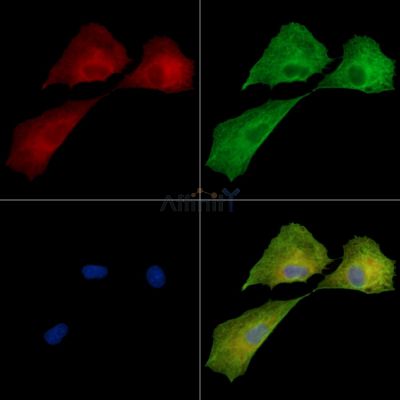 TRIM58 Antibody - DF16003 staining A549 cells by IF/ICC.