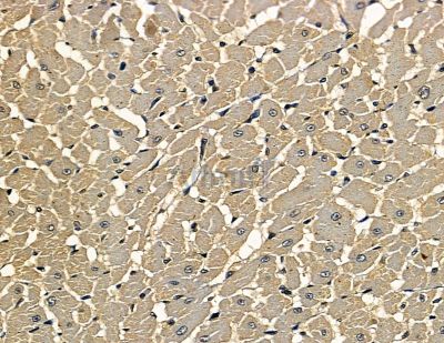 PLEKHG6 Antibody - DF16010 at 1/100 staining rat heart tissue by IHC-P.